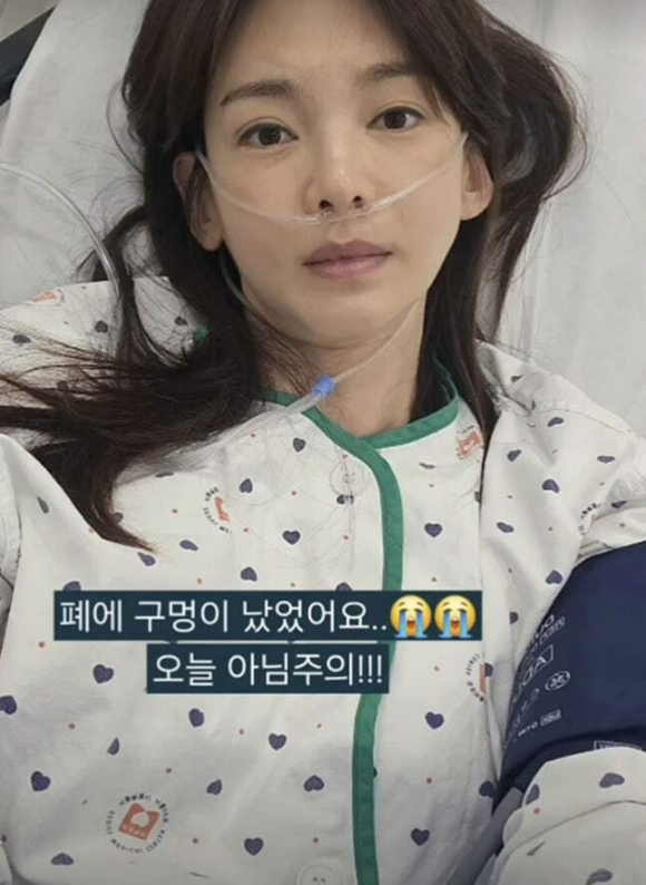 정가은, "폐에 구멍났었어요" 입원 근황 고백..."무사히 퇴원"