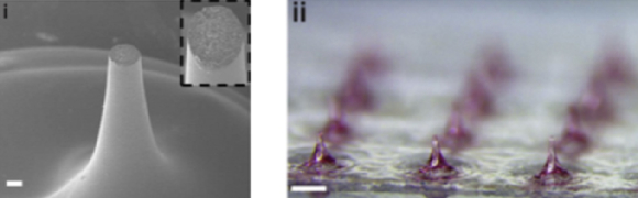 캡사이신 탑재 마이크로니들. [사진= 주빅]