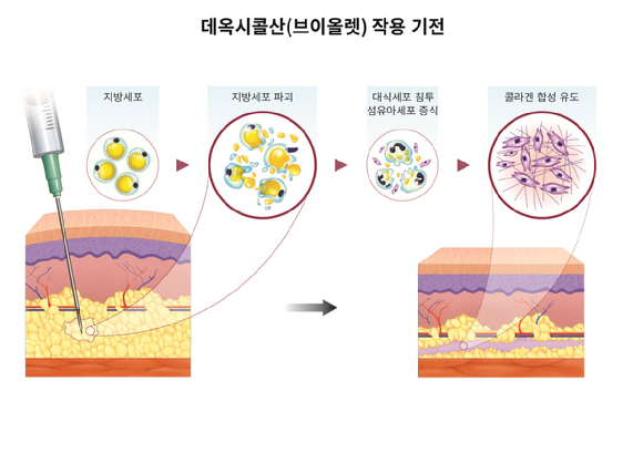 팔뚝 살 관련 이미지. 기사에서 언급된 제약사와 무관함. [사진=픽사베이]