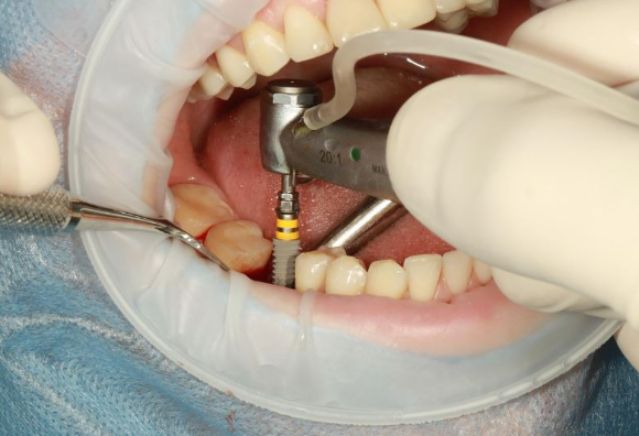 사진은 본 기사 내용과 무관. [사진=Voss Dental]