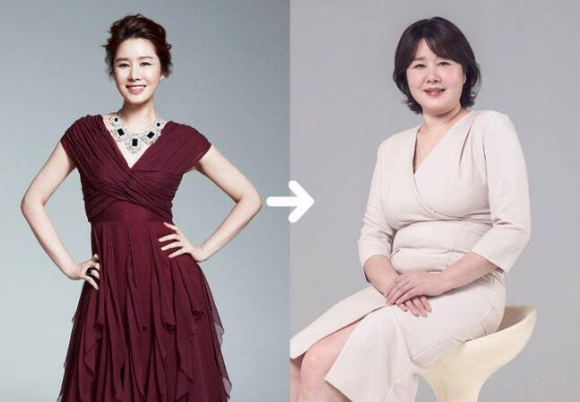 미스코리아 진 김지연, 75kg까지 찐 근황 &quot;갱년기·우울증 초기&quot;