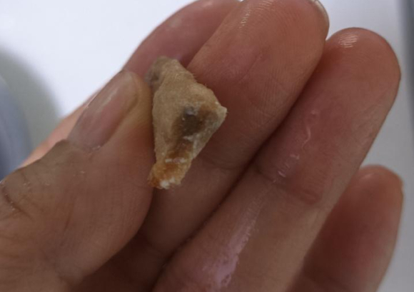 중국산 냉동 해물모듬에서 담배꽁초가 나왔다는 사연이 전해졌다. 사진은 해당 담배꽁초. [사진=온라인 커뮤니티]