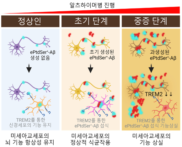 초기 단계에서는 TREM2가 높은 미세아교세포가 ePtdSer 양성 Aβ 플라크를 잘 제거하는데 알츠하이머병이 진행됨에 따라 TREM2 발현이 감소해 식균작용 효율이 떨어진다. [사진=서울대]