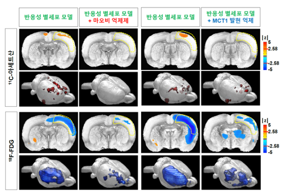 노란색으로 표시된 영역에서 반응성 별세포화를 유도했을 때, 탄소11-아세트산 흡수가 증가(주황색)하고, 불소18-플루오로데옥시글루코오스 흡수가 감소(파란색)하는 것을 확인했다. 이러한 변화는 마오비(MAO-B) 억제제(KDS2010)로 반응성 별세포화를 억제하거나(왼쪽), MCT1 유전자의 발현을 억제할 경우(오른쪽) 정상 수준으로 회복됐다. [사진=IBS]