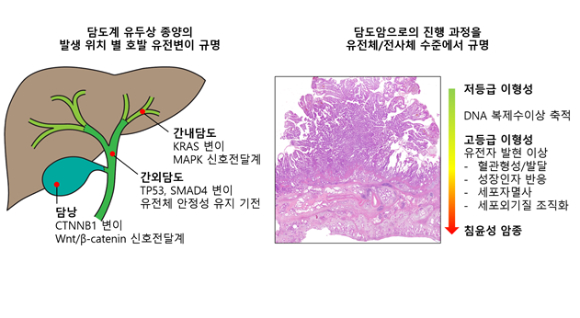 담도계 유두상 종양과 담도암 환자 166명의 종양 조직을 이용한 염기서열분석과 공간전사체 분석 결과, 같은 담도계에서도 해부학적 발생 위치에 따라 유전자 변이에 상당한 차이를 보였다(왼쪽). 암으로 진행되는 과정에 혈관형성·발달, 성장인자에 대한 반응, 세포외기질 조직화 관련 유전자 등의 발현에 이상이 발생한다는 점을 규명했다(오른쪽). [사진=연세대]