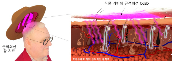 일상생활에서 자연스럽게 착용하는 모자에 탈모 예방 기술을 적용한 새로운 시스템이 개발됐다. [사진=KAIST]