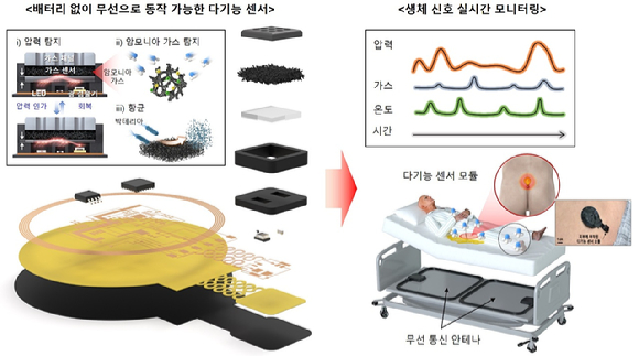고령·장애인에 고통 &apos;욕창&apos;…피부 접촉만으로 조기 진단