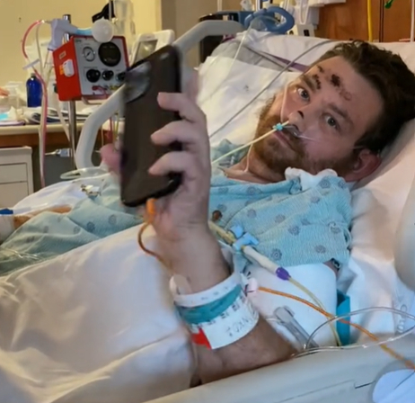 30대 후반 미국 남성 스티븐 스피날레는 사타구니에 생긴 인그로운 헤어를 무리하게 뽑다 패혈성 쇼크로 혼수상태에 빠졌으나, 여러 차례의 수술 후 기적적으로 의식을 되찾았다. [사진=데일리메일]