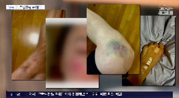 방송을 통해 유명해진 셰프 A씨가 운영하는 서울 서초구 레스토랑에서 지난해 11월 유리창이 넘어져 길을 가던 여성을 다치게 하는 사고가 발생했다. 그러나 셰프 측이 합의금을 지급하지 않아 피해자로부터 고소를 당했다. 사진은 방송화면. [사진=TV조선]