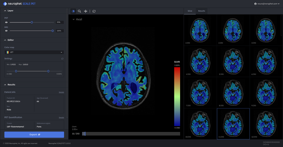 뉴로핏이 식품의약품안전처로부터 뇌 영상 분석 소프트웨어 ‘뉴로핏 스케일 펫(NEUROPHET SCALE PET-A)’의 2등급 의료기기 인증을 획득했다. [사진=뉴로핏]