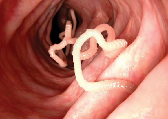 극단적인 해독법의 일종인 '촌충 다이어트'가 과거와 현재를 막론하고 건강을 위협해 왔다는 전문가들의 지적이 제기됐다. 사진은 본 기사 내용과 무관. [사진=픽사베이]