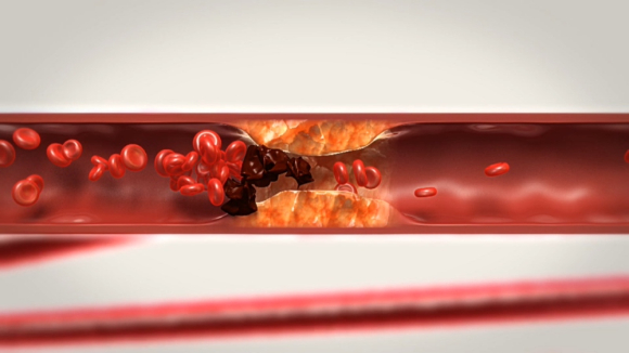 EBS '명의' 스틸컷. [사진=EBS]