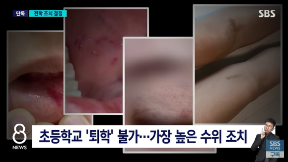 서울 양천구의 한 초등학교 여교사가 자신의 6학년 제자로부터 발로 짓밟히는 등 무차별 폭행을 당한 사건과 관련해 가해 학생 부모가 뒤늦게 사과하고 싶다는 뜻을 전했다. [사진=SBS 보도화면 캡처]