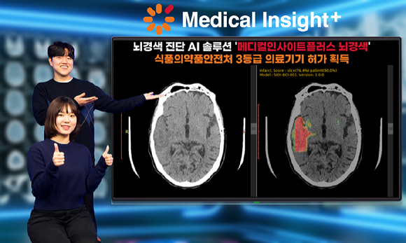 SK C&C는 뇌경색 진단 AI솔루션 '메디컬인사이트플러스 뇌경색'이 식품의약품안전처로부터 3등급 의료기기 품목 허가를 받았다. [사진=SK C&C]