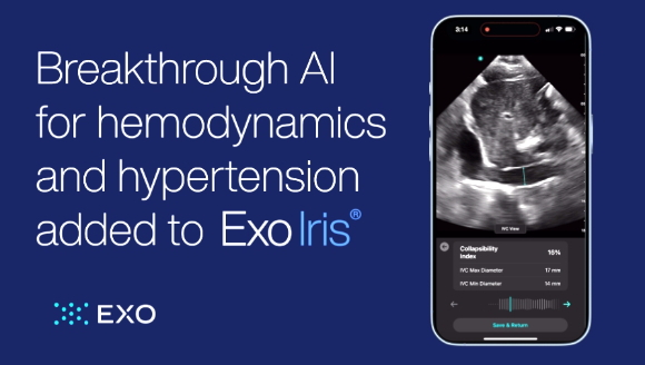 엑소 이매징의 모바일용 초음파 소프트웨어 사용 모습. [사진=엑소 이매징 홈페이지]