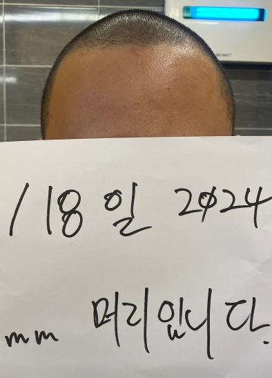 음식에서 머리카락이 나와 환불을 요청한다는 고객 요구에 자신의 짧은 머리를 공개한 업주 사연이 전해졌다. 사진은 A씨. [사진=온라인 커뮤니티 캡처]