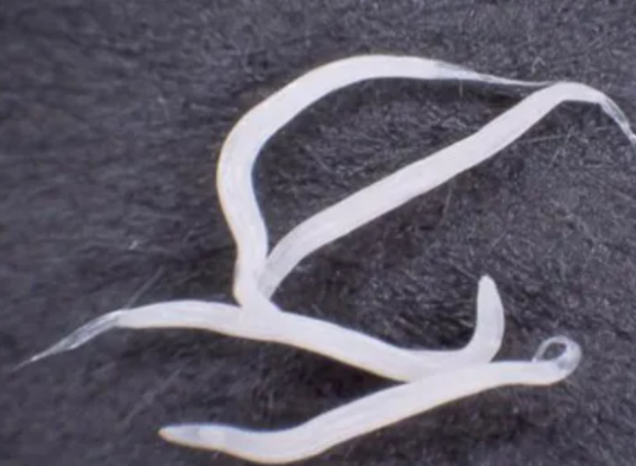 갑자기 항문 주위 가려움증이나 피부 발적 등이 나타난다면 요충증 감염을 의심해야 한다는 정부 기관의 권고가 공개됐다. 사진은 본 기사 내용과 무관. [사진=laketown-naishikyo]