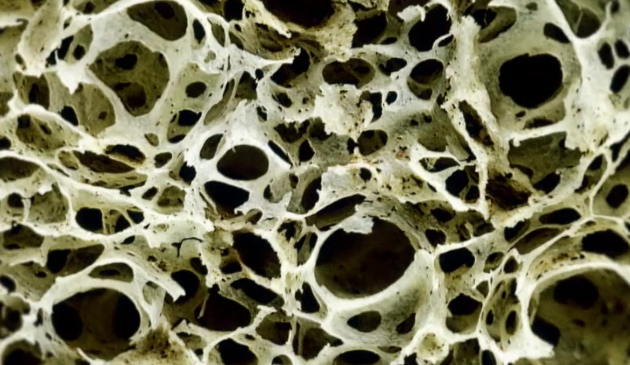 사진은 골다공증 이미지로, 본 기사 내용과 무관. [사진=EBS]