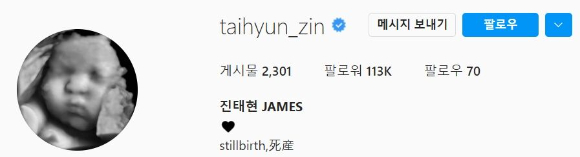 진태현 인스타그램의 프로필 사진은 여전히 태은이 초음파 사진이다. 그러나 소개글은 '사산'으로 바뀌었다. [사진=진태현 인스타그램]