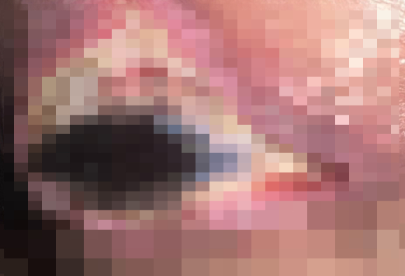 처진 살을 고민하던 30대 여성이 복부 성형, 가슴 리프팅, 지방흡입을 포함한 일명 '마미 메이크오버(mummy makeover)' 수술을 받았다가 심각한 부작용을 겪었다.사진은 수술 전 에리카 자코. [사진=더선]