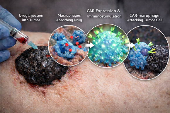 KAIST 연구팀이 종양 내부에서 면역세포를 직접 항암 세포치료제로 바꾸는 새로운 치료법을 개발했다. [사진=KAIST]