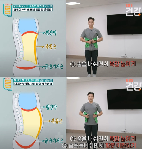 속은 더부룩한데 마음처럼 배변 활동이 이루어지지 않으면, 답답하기만 하다. [사진=픽사베이 @CDD20]