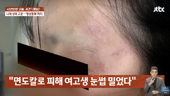 한 여고생이 자신보다 한 살 어린 여중생에게 폭행 및 성고문을 하고 피해 당시를 촬영까지 당한 사건이 벌어졌다. 사진은 피해하 얼굴. [사진=유튜브 채널 'JTBC News']