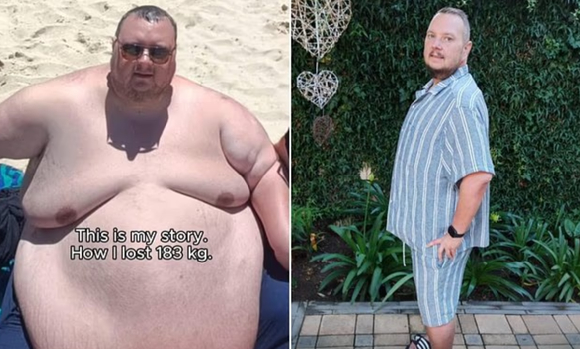 하루 12ℓ의 콜라와 식빵 두 통을 먹던 부부가 260㎏ 넘게 감량하며 새 삶을 찾았다는 사연이 알려졌다. 사진은 남편. [사진=데일리메일]