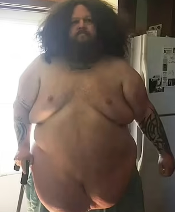 지팡이 없이는 걷지도 못했던 초고도비만의 50대 남성이 'DDP 요가'와 식단 조절을 통해 140㎏ 감량에 성공했다. 사진은 감량 전 켄 도어의 모습. [사진=데일리메일]