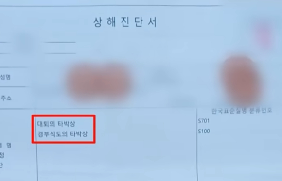 당시 사건을 재현한 인공지능(AI) 이미지. 실제 사진이 아님. [사진=JTBC '사건반장' 캡처]