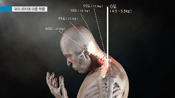 오는 29일 밤 9시 55분에 방송되는 EBS '명의' '목 통증, 원인부터 찾아라 &ndash; 경추 질환' 편에서는 한 번 손상되는 순간 영구적인 후유증이 생길 수 있는 경추 질환과 치료 방법에 대해 알아본다. [사진=EBS]