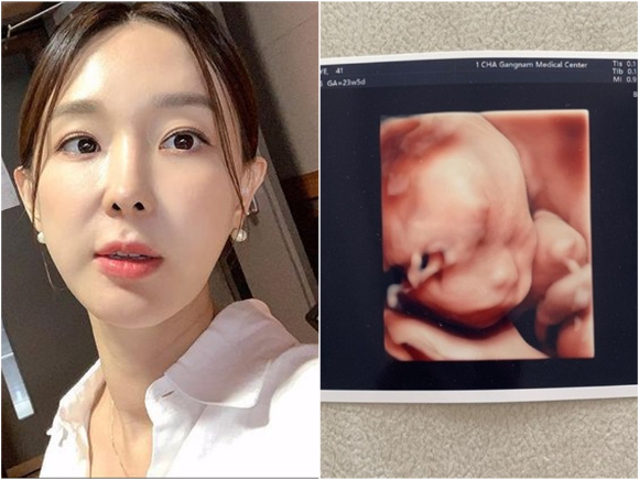 방송인 이지혜가 임신 중인 둘째의 초음파 사진을 공개했다.  [사진=이지혜 인스타그램]