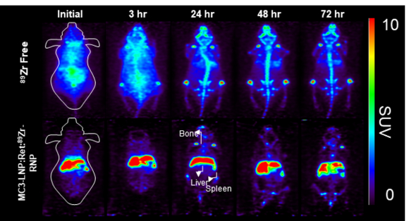 지르코늄-89(89Zr)와 합성한 크리스퍼 단백질이 간경화 질환을 가진 실험용 쥐에 투여되어 72시간동안 추적한 PET 영상자료 [사진=원자력연]