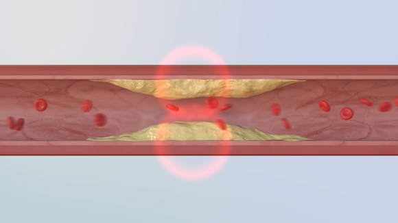 혈관 노화를 막지 못하면 최악의 경우 돌연사할 수도 있다. [사진=EBS]