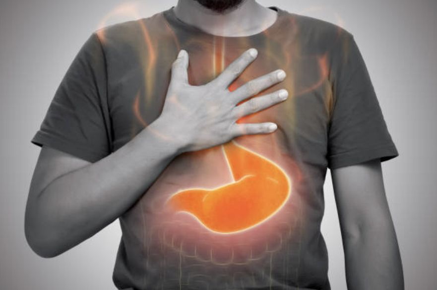 위식도역류질환 관련 이미지. [사진=픽사베이]