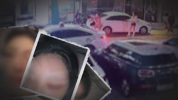 '궁금한 이야기Y' 보도 사진 [사진=SBS]