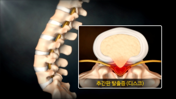 EBS '명의' 스틸컷. [사진=EBS]