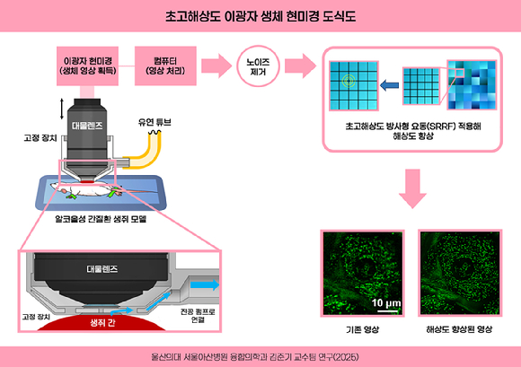 초고해상도 이광자 생체 현미경 도식도. [사진=서울아산병원]
