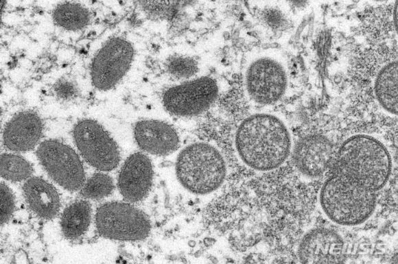 사진은 미국 질병통제예방센터가 공개한 원숭이두창 바이러스다 [사진=AP/뉴시스]