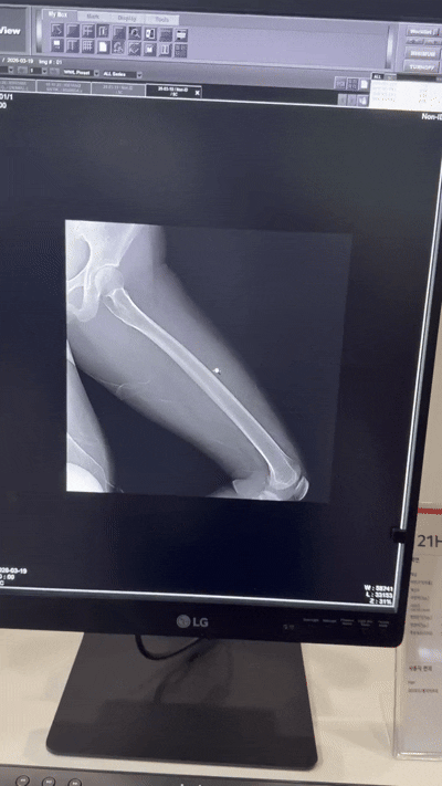 삼성전자 의료기기사업부와 삼성메디슨 부스. [사진=황세웅 기자]