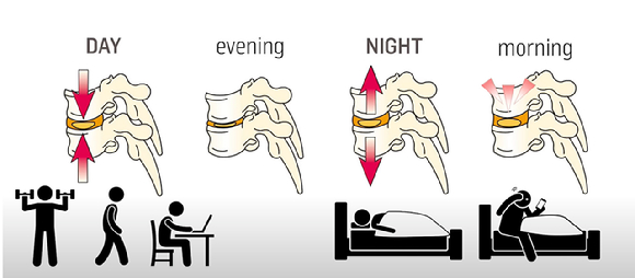 아침에 하는 허리 스트레칭의 경우에는 디스크가 터질 수도 있는 위험한 행동이다. [사진=픽사베이]