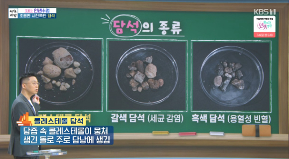 이종찬 분당서울대병원 소화기내과 교수가 '아침마당'에서 강의하고 있다. [사진=KBS 방송화면 캡처]