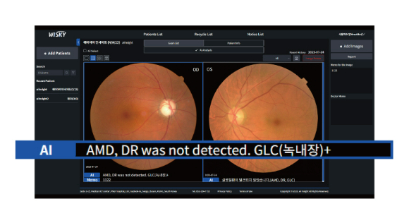 AI 실명질환 진단 보조 솔루션 '위스키(WISKY)'의 판독 이미지 [사진=대웅제약 제공]
