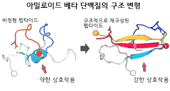 퇴행성 뇌질환인 알츠하이머는 아직 치료제가 없다. [사진=아이뉴스24DB]