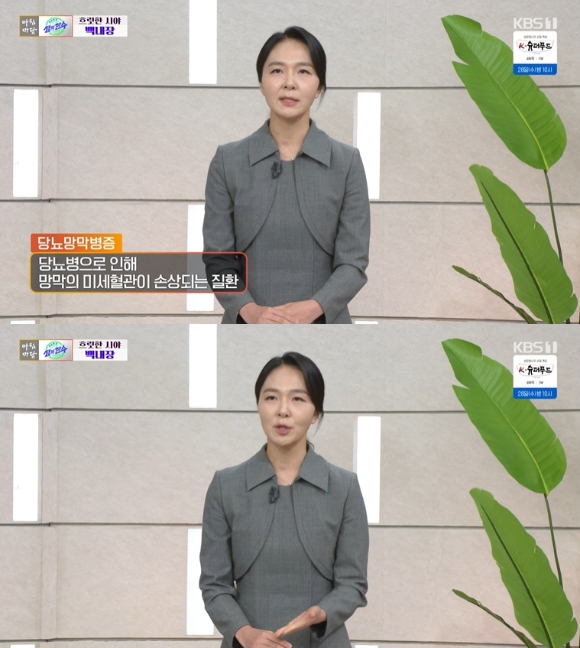 '아침마당' 김고은 교수 "백내장·노안 구분법? 돋보기 쓰면 알 수 있다"