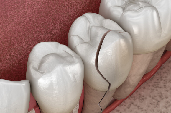 사진은 본 기사 내용과 무관. [사진=Voss Dental]